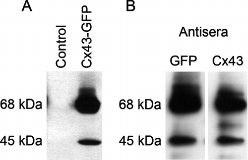 Figure 5 Cx43-GFP chimeric proteins present 2 immunoreactive forms of Cx43. Panel A: GFP-immunoreactive proteins were detected in HeLa cells that were either untreated (lane 1) or stably transfected with a construct expressing a Cx43-GFP fusion protein (lane 2). GFP was fused to the C-terminal of Cx43. Notice the presence of both a 68-kDa band and a 45-kDa fragment only in cells that were transfected with the fusion construct. Panel B: a Cx43-GFP construct was prepared in pEGFP-N1, which fused Cx43 to GFP just after the last amino acid in Cx43. This was transiently transfected into HeLa cells and the proteins were analyzed by immunoblot. The proteins were detected with either anti-GFP or anti-Cx43 antisera.