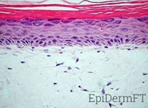 Figure 1 Histology of EpiDermFT. H&E stained paraffin section reveals epidermis containing basal, spinous, granular keratinocytes and stratum corneum. Dermis contains numerous viable fibroblasts (400X).