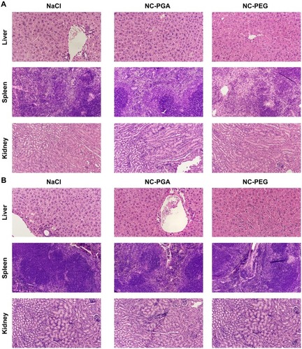 Figure 7 Histological examination of the liver, kidney and spleen isolated from animals after repeated administration of polyelectrolyte nanocapsules.Notes: Analysis was performed on (A) 30th or (B) 60th day of experiment.