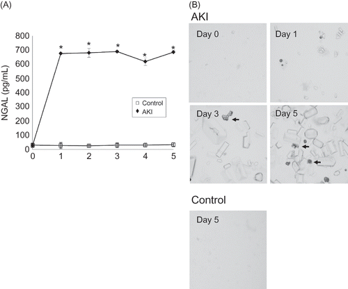 Figure 4. Change of urine neutrophil gelatinase-associated lipocalin (NGAL) in AKI mice (A). Urine NGAL increased in the mice from day 1 to day 5 after 0.75% adenine ingestion (n = 6 at each time point). Urine sediment analysis of AKI mice (B). Many adenine crystals with some granular casts (arrows) were detected in mice after 0.75% adenine ingestion. Note: *p < 0.05.