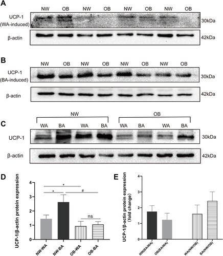Figure 4 UCP-1 protein expression in differentiated adipocytes. Western-blot images of UCP-1 protein band density of normal-weight group (NW) and obese (OB) group in WA (white adipocyte)-induced (A) and BA (beige adipocyte)-induced (B) adipocytes, and UCP1 protein band density of WA-and BA-induced adipocytes from the same adipose tissue sample in NW and OB group (C). (D) The analysis of UCP-1 protein band values in NW-WA, NW-BA, OB-WA and OB-BA groups. (E) Fold changes of UCP-1 protein expression in NW and OB group with WA- and BA-induction treatment. Values are mean ± SD; n= 12 for NW-WA, NW-BA, OB-WA and OB-BA groups; *p< 0.01 vs NW-WA group, #p< 0.01 vs NW-BA group.Abbreviation: ns, not significant.