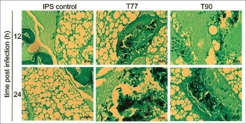 Figure 3. Histopathology of G. mellonella infected with A. terreus ATS strain T77, and ATR strain T90. Larvae were infected with IPS (left panel)), 1 × 107 spores per larvae of ATS T77 (middle panel) and of ATR T90 (right panel). Larvae were sacrificed at 12 h and 24 h after incubation at 37°C, conserved in formalin, embedded in paraffin. To identify the fungus more easily, tissue sections were stained with Grocott´s silver stain.