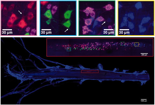 Figure 5. MIP images of multi-tracks in a holistic view [motor neurons innervating tibialis anterior (blue), gastrocnemius (red), soleus (green), lateral muscle (magenta)]. White arrows: dendrites or axons around the soma.
