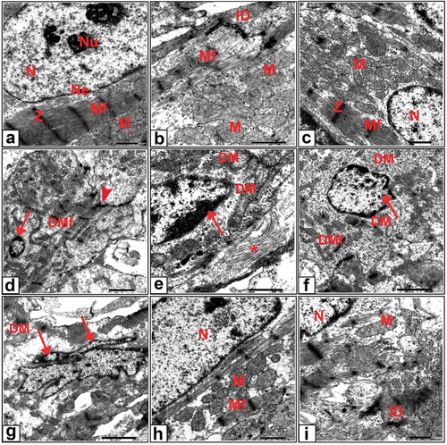 Figure 6. Transmission electron micrographs of cardiomyocytes from 20-day-old fetuses. (a , b) Control showed oval euchromatic nuclei, prominent nucleolus, regular nuclear envelope, will arrange myofibrils with Z lines, rows of mitochondria and highly coordinated intercalated discs (c) Ashwagandha, (d-g) Cloz showed degenerated myofibrils, degenerated intercalated discs, pyknotic and shrunken, nuclei with marginated chromatin, degenerated mitochondrial damage and accumulation of collagen. (h-i) Cloz + ashwagandha groups.