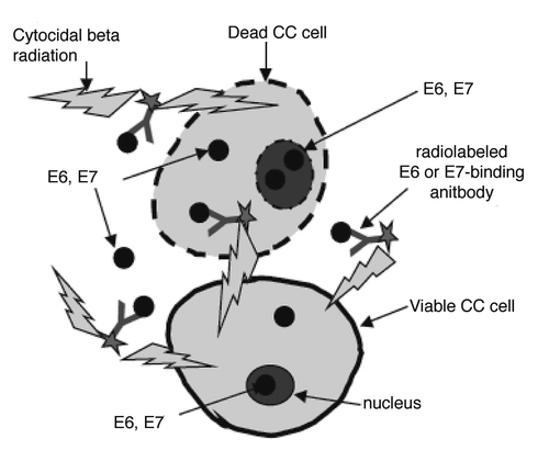 Figure 1 Diagram illustrating the mechanism of cervical cancer RIT with radiolabeled E6 or E7-binding mAbs. E6 and E7 proteins become accessible to mAbs in the non-viable cells and in the interstitial space as a consequence of cellular turnover in a fast-growing tumor. The mAbs bind to accessible E6 and E7 and deliver cytotoxic radiation to the tumor. Viable cancer cells are killed by radiation penetrating several cells diameters (so called “cross-fire” effect). CC, cervical cancer.