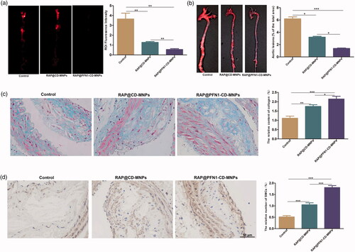 Figure 6. Therapeutic effect and pathological analysis of the carotid artery after various treatments. (a) NIRF of aorta at 2 months after treatment. (b) General ORO staining. (c) Relative collagen content determined by Masson's trichrome staining. (d) Immunohistochemical analysis using α-SMA antibodies. Representative pathological images (left) and quantitative results (right) are illustrated. Animals in the control group were administered saline (*p < .05, **p < .01, ***p < .001).