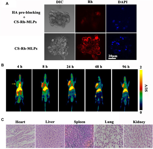 Figure 5 Uptake of CS-MLPs by CD44 overexpressing cells and distribution in vivo. (A) Fluorescence images of the pre-blocking and target groups. (B) Micro PET images of nude mice bearing subcutaneously implanted human xenografts of MDA-MB-231 cells at 4, 8, 24, 48, and 96 h. Images show high levels of 89Zr-labeled CS-MLPs accumulation in the tumor (left side of axillary). Yellow arrows indicate the tumor. (C) Histological images of heart, liver, spleen, lung, and kidney.