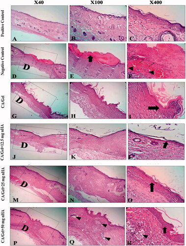 Figure 5. Haematoxylin–eosin-stained (H&E stained) microscopic sections of healed incisions in rats at 14 d: D: defect; positive control: normal skin; negative control: sterile gauze-treated wound; thick arrows in E: crusty scab; thick arrows in L: epidermal proliferation; arrows head in Q and R: foreign body reaction; thin arrow in R: chronic inflammatory cells.