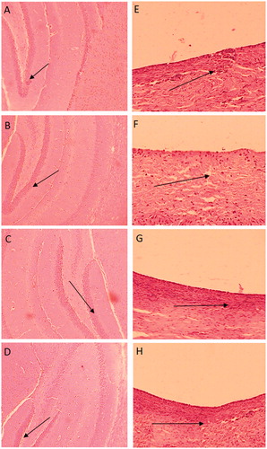 Figure 10. Representative photomicrographs showing the TS of rats' brain (A, B, C and D) and nasal mucosa (E, F, G and H) for normal control, PNIPAM-NPs (placebo), CUR-PNIPAM, DMC-PNIPAM and BDMC-PNIPAM-treated groups, respectively after 14 days.