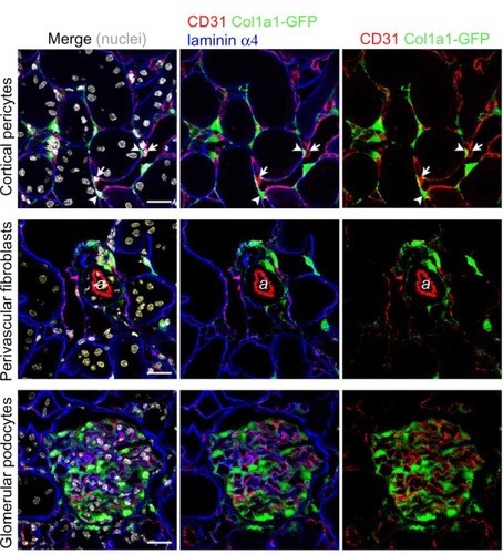 Figure 1 Characterization of microvascular pericytes and perivascular fibroblasts in normal adult kidney of Col1a1-GFPTg mice.