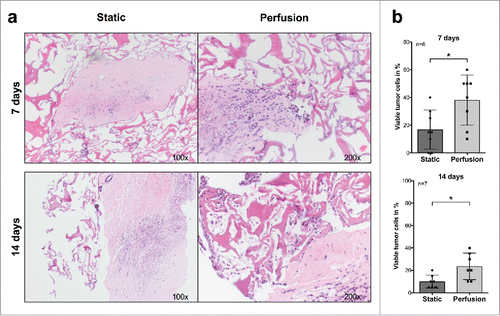 Figure 1. Comparative analysis of breast cancer tissue specimens upon culture in static conditions or under perfusion. (A) Fragments from a representative surgically excised breast cancer specimen were cultured for the indicated time points in static or perfused culture conditions. Samples were then fixed, paraffin embedded, and sections were HE stained (Magnification 100× (Static) and 200× (Perfusion)). (B) Comparative analysis of percentages of vtc in fragments from at least seven different breast cancer surgical specimens cultured in static or perfused conditions for the indicated time points (*p ≤ 0.05; **p ≤ 0.01).