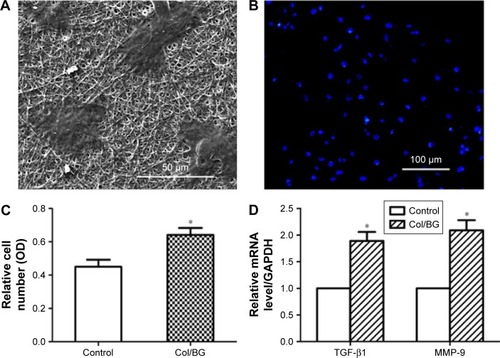 Figure 3 Biological effects of HaCaTs induced by the Col/BG nanofibers.Notes: (A) SEM photographs of HaCaTs cultured for 24 h. Magnification ×1000. (B) Fluorescence microscopy photographs of HaCaTs cultured for 24 h. Cell nuclei were stained with DAPI (blue). Magnification ×200. (C) The viability of HaCaTs cultured for 24 h. (D) Gene expression of TGF-β1 and MMP-9 in HaCaTs cultured for 3 days. The control group was cultured on cover slips. The results presented as the mean ± StD. *P<0.05 indicates statistically significant difference between the control and Col/BG groups.Abbreviations: Col/BG, collagen/bioactive glass; DAPI, 4,6-diamidino-2-phenylindole; GAPDH, glyceraldehyde 3-phosphate dehydrogenase; HaCaTs, human keratinocytes; MMP-9, matrix metalloproteinase-9; OD, optical density; StD, standard deviation; SEM, scanning electron microscopy; TGF-β1, transforming growth factor-β1.