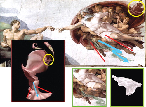 Figure 4 Amniotic fluid flow. On the right side: a detail of God's vest and a specimen of amniotic membranes. In the circle: round ligament and the salpinx.