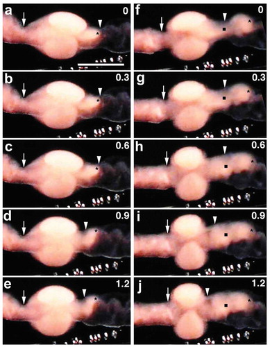 Figure 7. Clitellar region of a worm undergoing cocoon deposition. Anterior is to the left. Numerals shown in the upper right of each panel indicate the time (sec) after the onset of the movement of the segments. (a-e) and (f-j) show the backward withdrawal of segments 12 and 11, respectively, through the posterior margin (arrowhead) of the cocoon. Asterisks indicate the posterior margin of segment 12. Solid squares indicate the posterior margin of segment 11. vv, ventral vessel. Scale bar = 1 mm.