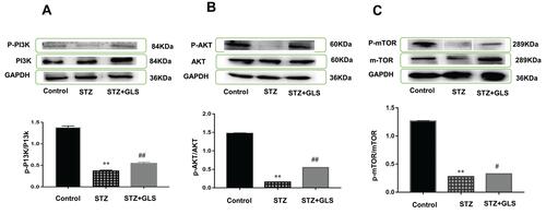 Figure 7 Effect of Ganoderma lucidum spores (GLS) on the protein expression of p-PI3K (A, molecular weight, 85 kDa), p-Akt (B, molecular weight, 60 kDa), and p-mTOR (C, molecular weight, 250 kDa) according to Western blot results (top) and their statistical analysis (bottom). Values represent the mean ± SE; n = 3 in each group. **, p < 0.01 versus the control group and #, p < 0.05 or ##, p < 0.01 versus STZ group using Tukey’s test. Control: 5 mL/kg saline (p.o.); Diabetic: 50 mg/kg streptozotocin (i.p.) and 5 mL/kg saline (p.o.); STZ+GLS: 50 mg/kg streptozotocin (i.p.) and 300 mg/kg GLS (p.o.).