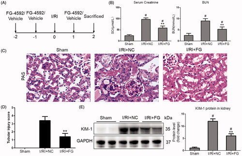 Figure 1. FG-4592 attenuated I/R-induced AKI. (A) Schematic diagram of the experimental design. In brief, mice were administrated with FG-4592 or vehicle before performing ischemia/reperfusion injury. And the mice were sacrificed at 48 h after disease induction. (B) Serum creatinine and BUN levels. (C) Representative images of PAS staining of kidneys (×400). (D) Tubular injury score in mice. (E) Western blot analysis of KIM-1 in renal cortex tissue lysates. n = 6 mice per group. Data are presented as mean ± SD, **p < .01 vs. I/RI + NC mice, #p < .05 vs. sham mice, ANOVA followed by Bonferroni correction.