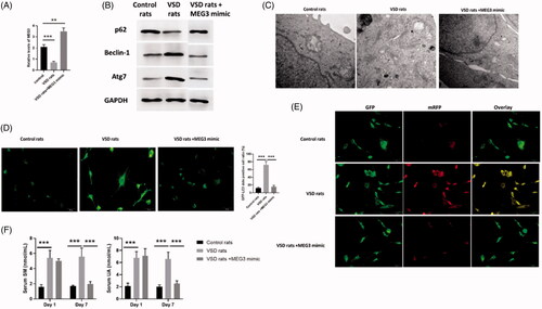 Figure 7. LncRNA MEG3 regulated UA and SM-induced autophagy in cardiomyocytes in vivo study. (A) MEG3 was decreased and increased in VSD rats and VSD rats treated with MEG3 mimic, respectively. (B) p62 protein level was decreased and increased in VSD rats and VSD rats treated with MEG3 mimic, respectively. Beclin-1 and Atg7 protein levels were increased and decreased in VSD rats and VSD rats treated with MEG3 mimic, respectively. (C) Autophagic levels were increased and decreased in VSD rats and VSD rats treated with MEG3 mimic, respectively, as assessed by TEM (scale bar: 200 nM). (D) The number of GFP-LC3 positive cells was increased and decreased in VSD rats and VSD rats treated with MEG3 mimic, respectively, as assessed by GFP-LC3 adenovirus-transfected autophagic vesicle assay (scale bar: 50 μM). (E) GFP signals were increased and decreased in VSD rats and VSD rats treated with MEG3 mimic, respectively, assessed by GFP and RFP tandemly tagged LC3 (tfLC3) assays (scale bar: 50 μM). (F) Serum UA and SM were determined by ELISA assay in VSD rats and VSD rats treated with MEG3 mimic. Values are mean ± SEM. For each experiment, three samples at least were available for the analysis. *p < .05, **p < .01, ***p < .001.