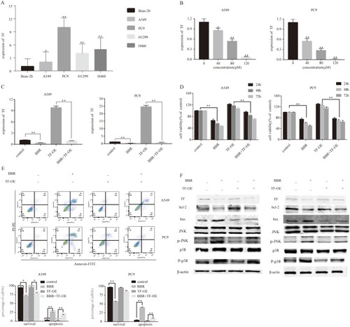 Figure 5 Berberine induces apoptosis by regulating the miR-19a/TF/MAPK axis in NSCLC. (A) qRT-PCR analysis of TF expression in BEAS-2B, A549, Pc9, H1299 and H460 cell lines. (B) Berberine up-regulates TF expression in A549 and Pc9 cells in a dose-dependent manner. (C) qRT-PCR analysis of TF expression in control and TF overexpression groups ± berberine (80 μM) for 48 h. (D) Percentage of relative cell viability after berberine treatment and TF overexpression for 48 h. (E) Suppression of TF overexpression by berberine significantly increases apoptosis. (F) Western blot analysis was performed to assess the effects of miR-19a on the expression of apoptosis-related proteins in response to berberine. Mean values of at least three independent experiments are shown. Values are expressed as mean ± SD, *P<0.05; **P<0.001, compared with the vehicle control (0.008% DMSO).