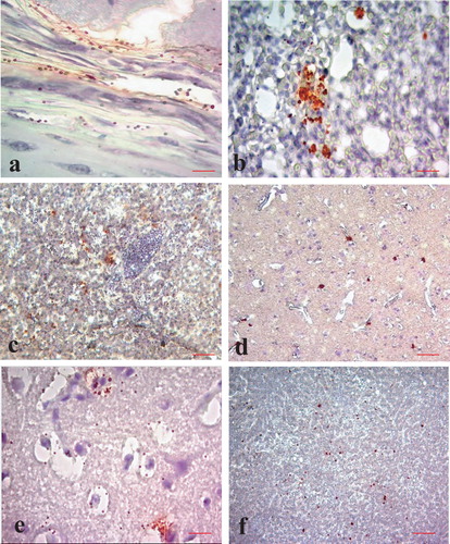Figure 3. Immunohistochemical localization of avian influenza virus antigen in different tissues of ducks and quails (IHC counter stained with haematoxylin). Tissue sections from avian influenza infected ducks showing virus antigen in the (a) peripheral chondrocytes (bar = 50 µm), (b) interstitial cells of lungs (bar = 25 µm), (c) cytoplasm of hepatocytes (bar = 50 µm), (d) neurons and glial cells (bar = 50 µm) and (e) degenerating neurons (bar = 50 µm) of brain. (f) Section of pancreas from quail showing virus antigen in the acinar cells of the pancreas (bar = 50 µm).