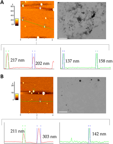 Figure 4 AFM (Topography) and SEM-FEG images of LNPs loaded with 100 µg/mL of plasmid with the «pre» method, as (A) fresh formulation, and (B) after 1 month of storage at 4°C. Profile analysis of AFM images is reported in the panel below each image. Scale bar: 1 µm.