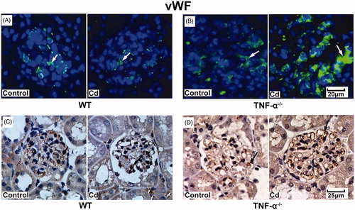 Figure 3. Effects of Cd on vWF protein expression in glomeruli from TNF-α−/− and WT mice. Representative images of vWF immunofluorescent staining in glomeruli of WT mice (A) and TNF-α−/− mice (B). Representative result of vWF expression in WT mice (C) and TNF-α−/− mice (D) using immunohistochemistry.