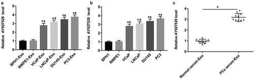 Figure 2. Expression of lncAY927529 in exosomes secreted by different prostate cells, prostate cells and clinical serum samples. (a) RT-qPCR was used to detected the lncAY927529 level in the exosomes of normal prostatic epithelial cells (BPH1 and RWPE1) and PCa cells (VCap, LNCap, DU145 and PC3). *P < 0.05 compared with BPH1-Exo; #P < 0.05 compared with RWPE1-Exo group. (b) RT-qPCR was used to detected the lncAY927529 level in normal prostatic epithelial cells (BPH1 and RWPE1) and PCa cells (VCap and LNCap, DU145, PC3). *P < 0.05 compared with BPH1; #P < 0.05 compared with RWPE1 group. (c) The lncAY927529 level in the exosomes of serum of healthy volunteers (n = 10) and PCa patients (n = 10). *P < 0.05 compared with normal serum-Exo group. N = 4, data were expressed as mean ± SEM; Student’s t test or one-way ANOVA was used for analyzing data