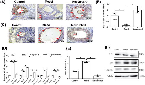 Figure 4. Effects of resveratrol treatment on the PCNA expression and apoptosis-related gene expression in the ovary of PCOS rats. (A) The PCNA protein expression in control rats, PCOS rats, and resveratrol-treated PCOS rats was determined by IHC. (B) The PCNA mRNA expression in control rats, PCOS rats, and resveratrol-treated PCOS rats was determined by qRT-PCR. (C) The apoptosis in the ovary was assessed using TUNEL assay. (D) The mRNA expression levels of Bax, Bcl-2, caspase-3, apaf1, and cytochrome C in control rats, PCOS rats, and resveratrol-treated PCOS rats were determined by qRT-PCR. (E) The ratio of Bax/Bcl-2 in control rats, PCOS rats and resveratrol-treated PCOS rats was determined by qRT-PCR. (F) The protein expression of Bcl-2, Bax, and caspase-3 in control rats, PCOS rats, and resveratrol-treated PCOS rats was determined by western blot. Red arrows indicated the positively stained cells. N = 6; *p < 0.05 indicated the significant different between different treatment groups.