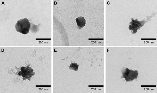 Figure 3 TEM image of plasmid/stPEI/HSA NPs noncovalently bound to plasmid and siRNA.Note: (A) F25P0, (B) F25P1, (C) F25P5, (D) F25P10, (E) F25P0S0.5, and (F) F25P1S0.5.Abbreviations: HSA, human serum albumin; NPs, nanoparticles; stPEI, stearyl polyethylenimine; TEM, transmission electron microscopy.