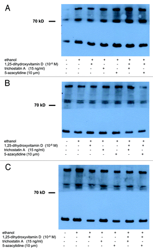 Figure 3. Treatment with UV-B, 1,25(OH)2D3 and epigenetic drugs, alone or in combination, does not exert strong effects on protein expression of Jagged-1 in non-malignant and in malignant human keratinocytes. Western analysis revealed that Jagged 1 protein is expressed in cultured non-malignant (HaCaT keratinocytes) and malignant (SCL-1 cells) human keratinocytes. Results of representative experiments in HaCaT keratinocytes 48 h after UV-B irradiation are shown here. Please note that treatment with UV-B [(A) 0 J; (B) 100 J; (C) 500 J] and/or 1,25(OH)2D3 (10−8 M) does not exert strong effects on protein expression of Jagged 1 after 24, 48 or 72 h. Please also note that treatment with epigenetic modulating drugs (TSA, 5-Aza) does not exert pronounced effects, alone or in combination with UV-B and/or 1,25(OH)2D3, on protein expression of Jagged 1 in HaCaT keratinocytes. Western analysis of GAPDH protein (lower band) served as control.