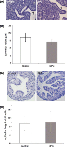 Figure 1. Uterine endometrial cell height and oviduct cell height are not affected by perinatal BPS exposure. (A) H&E staining of uterine sections from unexposed and BPS-exposed females. The endometrial layer is indicated by arrows. Photomicrographs were collected with a 20× EpiPlan Objective. (B) Quantification of endometrial cell height in unexposed (control) and BPS-exposed females. (C) H&E staining of oviduct sections from unexposed and BPS-exposed females. Photomicrographs were collected with a 20× EpiPlan Objective. (D) Quantification of oviduct cell height in unexposed (control) and BPS-exposed females.