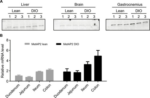 Figure 4 Comparison of MetAP2 protein and mRNA expression levels in lean mice and DIO mice.