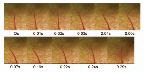 Figure 12 Strong jets of air can bend the trigger hair, and thus lead to trap closure. The trigger hair was significantly bent twice, which initiated the closure.