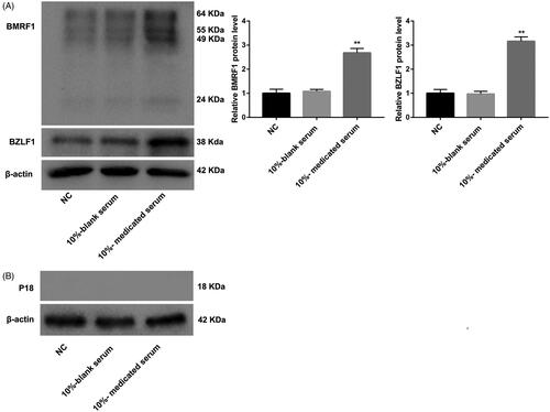 Figure 3. SQBD inhibits lytic EBV replication in CGM1 cells. CGM1 cells were treated with 10%-medicated serum or 10%-blank serum. 10% FBS-treated CGM1 cells served as NC. (A) WB was performed to explore the expression of immediate early lytic protein BZLF1 and the early lytic protein BMRF1 in the CGM1 cells. (B) WB was performed to assess the expression of p18 in the CGM1 cells. (**p < 0.01 vs. 10%-blank serum group).