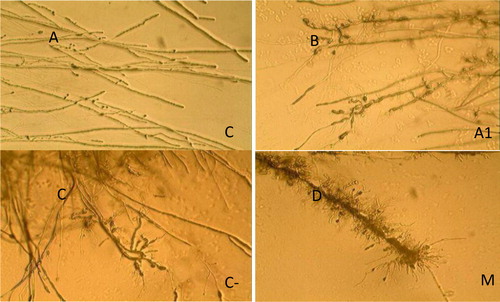 Figure 2. Effects of the mixed-culture filtrate against Verticillium dahliae mycelia observed under a microscope.Note: A.CK: Morphology of hyphae uninhibited by fermentation broth; B.A1: Morphology of hyphae inhibited by A1 monoculture fermentation filtrate; C.C-9: Morphology of hyphae inhibited by C-9 monoculture fermentation filtrate; D.M: Morphology of hyphae inhibited by the mixed-culture fermentation filtrate of A-1 and C-9.