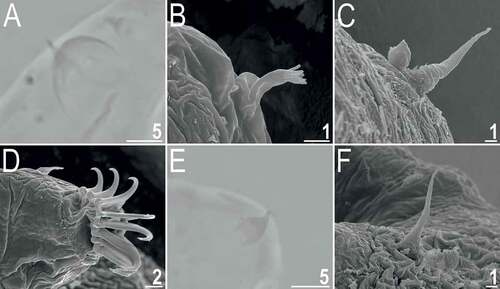 Figure 8. Cephalic and trunk appendages of Echiniscoides bufocephalus sp. nov.: A. peribuccal cirri and secondary clava (PCM), B. cirrus internus in close-up (SEM), C. cirrus A and primary clava (SEM), D. sensory organ on leg II (SEM), E. sensory organ on leg III (PCM), F. cirrus E (SEM). Scale bars in μm.