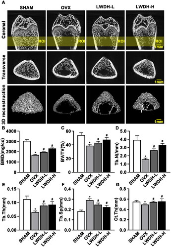 Figure 2. LWDH attenuates the bone loss caused by OVX. (A) 3D reconstruction of representative images of the coronal and cross-sectional surfaces of the distal femur at 8 weeks after surgery in each group. The highlighted area of the Coronal row is region of interest (ROI). (B-G) Micro-CT analyses of bone mineral density (BMD), bone volume/total volume (BV/TV), trabecular number (Tb. N), trabecular thickness (Tb. Th), trabecular separation (Tb. Sp) and midshaft cortical thickness (Ct. Th). (n = 6, *p < 0.05 vs. Sham; #p < 0.05 vs. OVX by one-way ANOVA test.)