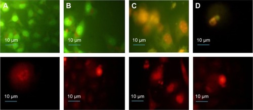 Figure 4 Fluorescence microcopy images of HeLa cells stained with AO (first row) and EB (second row) after exposure to NOP-DOX@BSA-FA and a light dose.Notes: (A) Cells exposed for 5 minutes showing the formation of apoptotic bodies within the cells; (B) apoptotic and necrotic cells at 15 minutes, with 50% of the cells showing necrosis and the remaining showing early and late apoptosis; and (C, D) apoptotic and necrotic cells at 30 minutes exposure showing nuclear condensation, budding to form apoptotic bodies, and nuclear fragmentation. Magnification is 60×.Abbreviations: AO, acridine orange; BSA, bovine serum albumin; DOX, doxorubicin; EB, ethidium bromide; FA, folic acid; HeLa, human cervical epithelial malignant carcinoma; NOP, nickel oxide nanoparticle.
