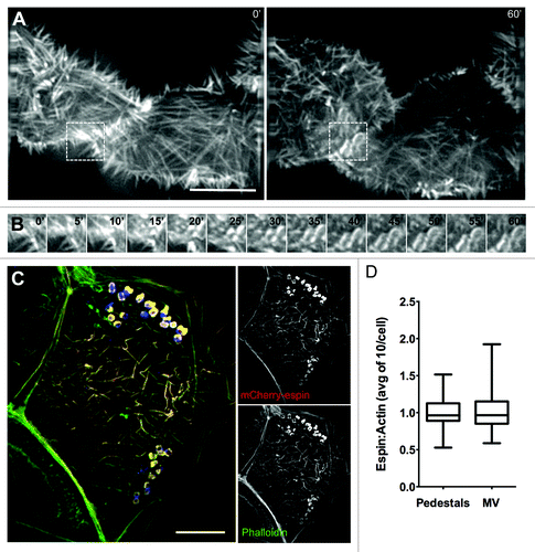 Figure 5. The parallel actin-bundling protein espin localizes to nascent pedestals in developing A/E lesions. (A) Deconvolution images of mCherry-espin-expressing Caco-2BBE cell at 0 min (Left) and 60 min (Right) after initial EPEC attachment. (B) Frames at 5 min intervals from boxed region in (A), showing espin accumulation in the developing pedestal. (C) Deconvolution image of fixed, EPEC infected Caco-2BBE cell expressing mCherry-espin (red) and stained with phalloidin (green) and α-LipidA (blue). (D) Quantification of the ratio of mCherry-espin to actin signal in pedestals and microvilli of fixed, EPEC-infected Caco-2BBE cells. Scale bars in (A, C) = 10 μm.