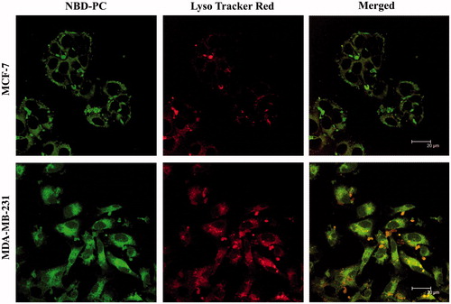 Figure 6. Intracellular uptake of NLC into MCF-7 cells and MDA-MB-231 cells by confocal laser scan microscope images. NLC containing NBD-PC (green) and Lysotracker Red (red) staining lysosome were used for this experiment.