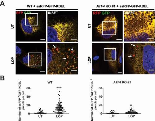 Figure 8. LOP-triggered reticulophagy depends on ATF4. (A) Stable ssRFP-GFP-KDEL-expressing MZ-54 WT and ATF4 KO #1 cells were treated for 16 h with 17.5 µM LOP followed by confocal microscopy of ssRFP+/GFP-KDEL− and ssRFP+/GFP-KDEL+ structures. Scale bar: 20 µm (5 µm for insets) Asterisks highlight ssRFP+/GFP-KDEL− puncta. (B) Quantification of (A). Mean and SEM of the quantification of at least 36 cells from 4 independent experiments are shown. *** p < 0.001. UT, untreated