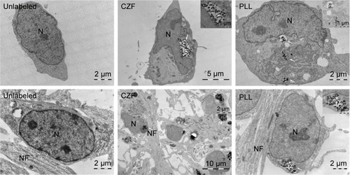 Figure 2 TEM confirmation of nanoparticles internalization.Notes: Top row: undifferentiated cells unlabeled and labeled with 15 μg Fe/mL CZF and PLL-coated γ-Fe2O3 (PLL) for 72 hours. Bottom row: differentiating cells unlabeled and labeled with 15 μg Fe/mL CZF and PLL-coated γ-Fe2O3 (PLL) for 72 hours. Insets show higher magnification views of nanoparticle clusters surrounded by membrane. Nanoparticle clusters are marked by arrows.Abbreviations: TEM, transmission electron microscopy; CZF, silica-coated cobalt zinc ferrite nanoparticles; PLL-coated γ-Fe2O3, poly-l-lysine-coated iron oxide super-paramagnetic nanoparticles; N, nucleus; NF, neurofilaments.