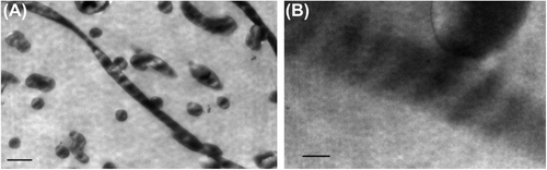 Figure 3. Transmission electron micrographs of electrospun collagen nanofibrous scaffolds exhibit the triple helical repeats of 67 nm D-periodicity banding pattern typical of native collagen (inserted scale bar 250 nm and 50 nm).