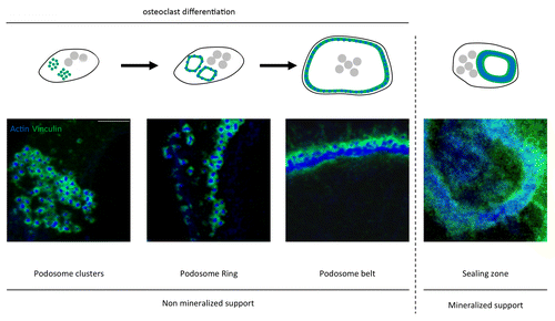 Figure 3. Dynamic of podosomes organization. Schemes and immunofluorescent staining of actin (podosome core in blue) and vinculin (podosome cloud in green) observed with Axioplan2/LSM 510 META confocal microscope (Zeiss), showing osteoclasts differentiation through the evolution of podosomes organization. On non-mineralized support, they first assemble into podosome clusters then into rings, which finally fuse into belts. On mineralized support, the sealing zone is the ultimate structure present in differentiated osteoclasts. It is characterized by a strong density and an important degree of podosome interconnectivity. Scale bar = 5 µm. Figure adapted from reference Citation72, with permission from the editor American Society for Cell Biology (ASCB).