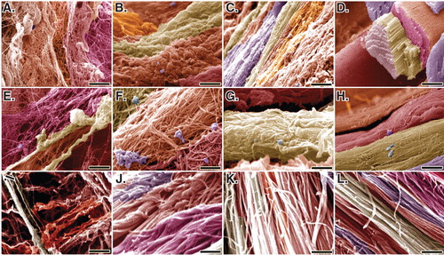 Figure 12. SEM characteristics of the injured and normal tendons at 60 days post-injury. A, E and I are injured control (no implant) tendons (ICTs). B, F and J are injured treated tendons with collagen implant (ITTCs). C, G and K are ITTC-Ps. D, H and L are normal healthy tendons for comparison. A – H are SEM figures at fiber level, while I to L are the SEM ultramicrographs at fibrillar level. Compared to the ICTs, those tendons treated with implants showed some degrees of collagen fibrils to fiber differentiation and fibrillar and fiber alignment. Compared to the ITTCs, treatment with platelets considerably improved collagen fiber formation (G vs F), collagen density and fiber and fibril alignment in the ITTC-Ps. Scale bar: A to D = 50 µm; E – H = 25 µm and I – L = 5 µm.