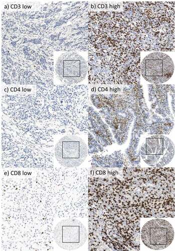 Figure 1. Immunohistological staining for CD3+, CD4+, and CD8+ cells in 400-fold magnification.