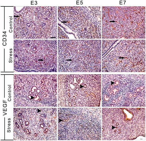 Figure 5. Immunohistochemical staining for CD34 and VEGF was used to identify angiogenesis and new microvessel formation. Long arrows indicate a CD34-positive cell and arrowheads indicate a VEGF-positive cell. E3: Embryonic day 3; E5: Embryonic day 5; E7: Embryonic day 7; VEGF: Vascular endothelial growth factor. Bar = 50 μm.