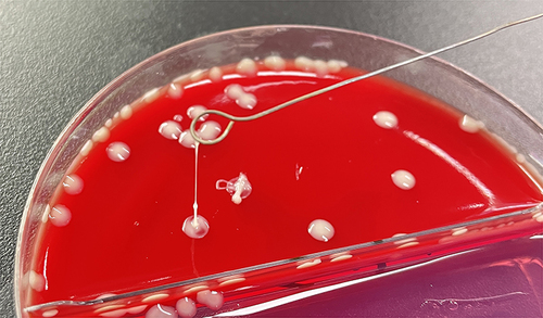 Figure 1 The string test in an isolated colony of Klebsiella pneumoniae from the CSF on an agar plate, which showed hypermucoviscosity with a > 5-mm-long viscous filament.