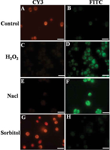 Fig. 5. Effect of H2O2, NaCl and sorbitol on mitochondrial membrane potential in Chlamydomonas reinhardtii. The control cells are fluorescing red indicating healthy and intact mitochondria (A); the cells treated with 10 mM H2O2 showed gradual increase in green fluorescence from 1 h till 3 h indicating altered mitochondrial membrane potential (D). Cells treated with 200 mM NaCl also showed altered mitochondrial membrane potential at 24 h (F) while sorbitol-treated cells are fluorescing red (H). Scale bar is 10 μm.