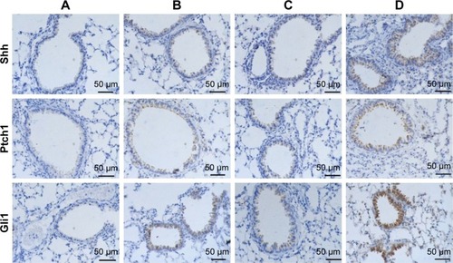 Figure 9 Immunohistochemical detection of Shh signaling pathway molecules.Notes: (A) Negative controls in which the primary antibody was replaced with PBS; (B) PBS group; (C) CSE group; (D) CSE + adenovirus group. All sections were counterstained with hematoxylin. Magnification ×200.Abbreviations: PBS, phosphate-buffered saline; CSE, cigarette smoke extract.