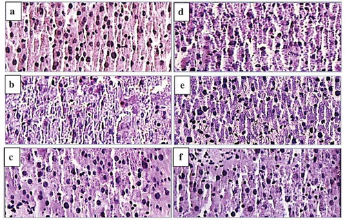 Figure 9. Effect of APP on liver histopathology of mice using H & E staining (original magnification of 400 times). Liver tissues of normal mice (a), Vehicle + CCl4 group (b), BP (450 mg/kg bw) + CCl4 group (c), APP (150 mg/kg bw) + CCl4 group (d), APP (300 mg/kg bw) + CCl4 group (e), APP (450 mg/kg bw) + CCl4 group (f).Figura 9. Efecto de APP en la histopatología de hígado de ratón utilizando coloración H y E (ampliación original de 400 veces). Los tejidos del hígado de ratones normales (a), Vehículo + grupo CCl4 (b), BP (450 mg/kg bw) + grupo CCl4 (c), APP (150 mg/kg bw) + grupo CCl4 (d), APP (300 mg/kg bw) + grupo CCl4 (e), APP (450 mg/kg bw) + grupo CCl4 (f).